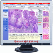 供应杰软病理影像系统工作站